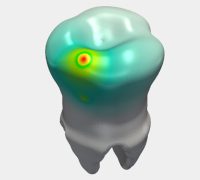 tooth simulation